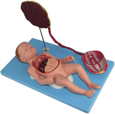 MON1137 BABY WITH PLACENTA