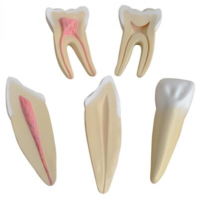MON376 ENLARGEMENT OF HUMAN TEETH