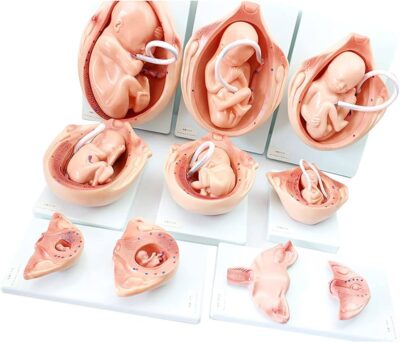MON800 THE DEVELOPMENT PROCESS FOR FETUS 10 PARTS
