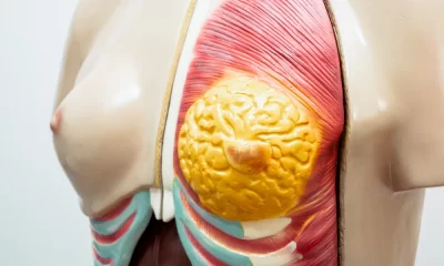MON791 THE MODEL OF MAMMARY DISSECTION