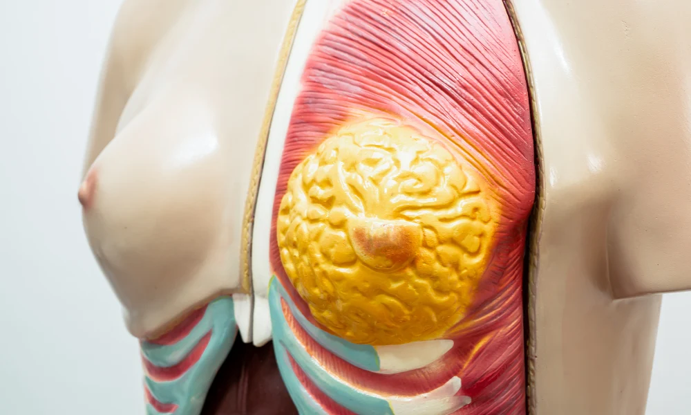 MON791 THE MODEL OF MAMMARY DISSECTION