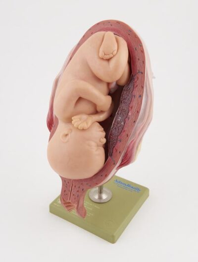 MON200 UTERUS W/EMBRYO [10 MONTHS]